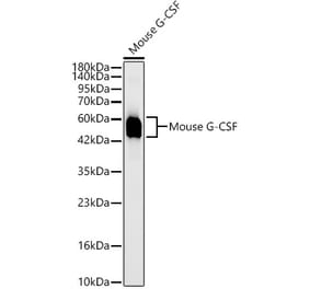 Western Blot - Anti-G-CSF Antibody [ARC63775] (A329394) - Antibodies.com