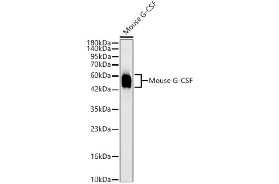 Western Blot - Anti-G-CSF Antibody [ARC63775] (A329394) - Antibodies.com