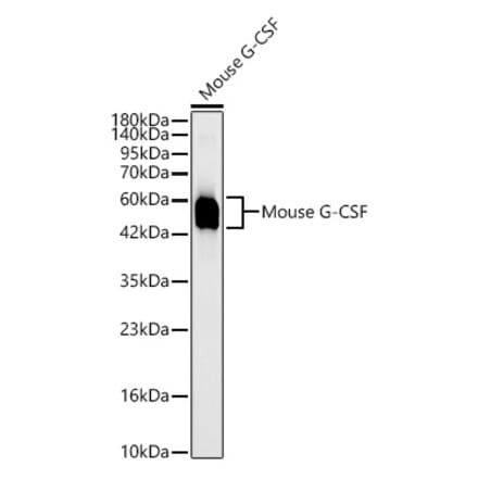 Western Blot - Anti-G-CSF Antibody [ARC63775] (A329394) - Antibodies.com