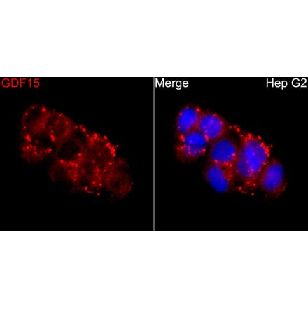 Immunofluorescence - Anti-GDF15 Antibody (A329395) - Antibodies.com