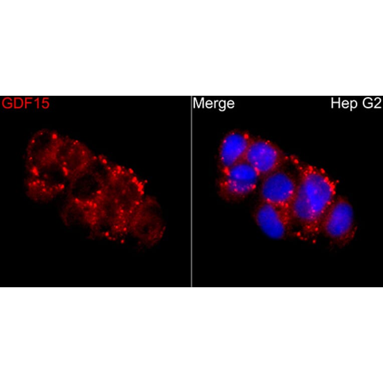 Immunofluorescence - Anti-GDF15 Antibody (A329395) - Antibodies.com