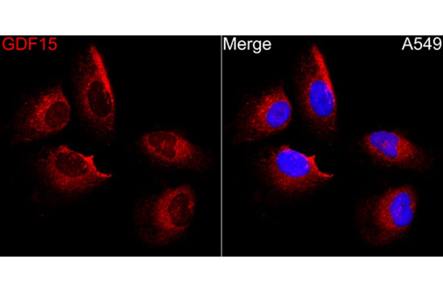 Immunofluorescence - Anti-GDF15 Antibody (A329395) - Antibodies.com