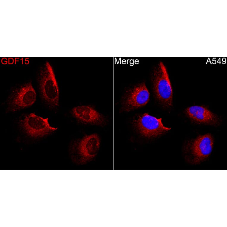 Immunofluorescence - Anti-GDF15 Antibody (A329395) - Antibodies.com