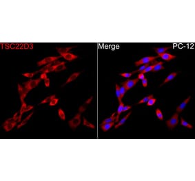 Immunofluorescence - Anti-GILZ Antibody (A329402) - Antibodies.com