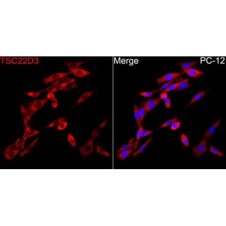 Immunofluorescence - Anti-GILZ Antibody (A329402) - Antibodies.com