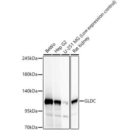 Western Blot - Anti-GLDC Antibody (A329404) - Antibodies.com