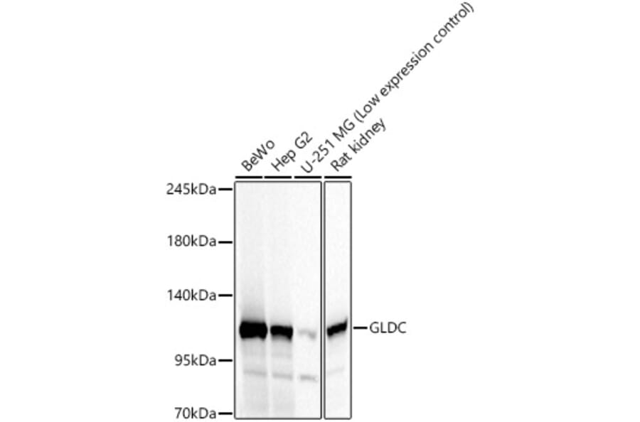 Western Blot - Anti-GLDC Antibody (A329404) - Antibodies.com