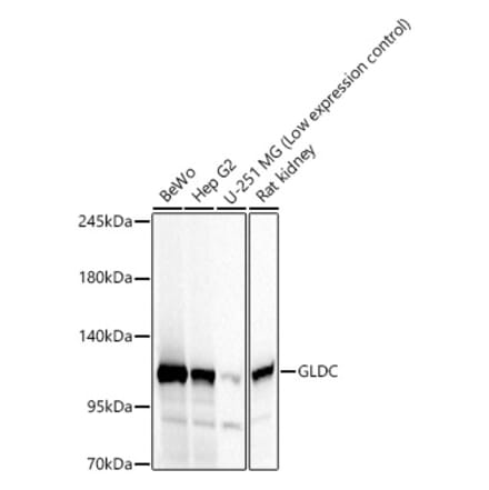 Western Blot - Anti-GLDC Antibody (A329404) - Antibodies.com