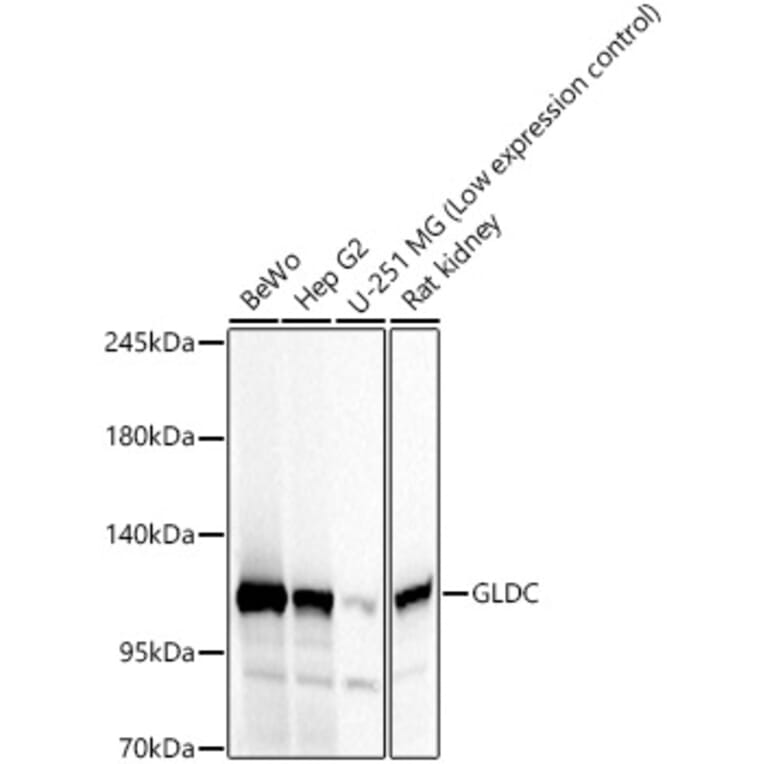Western Blot - Anti-GLDC Antibody (A329404) - Antibodies.com