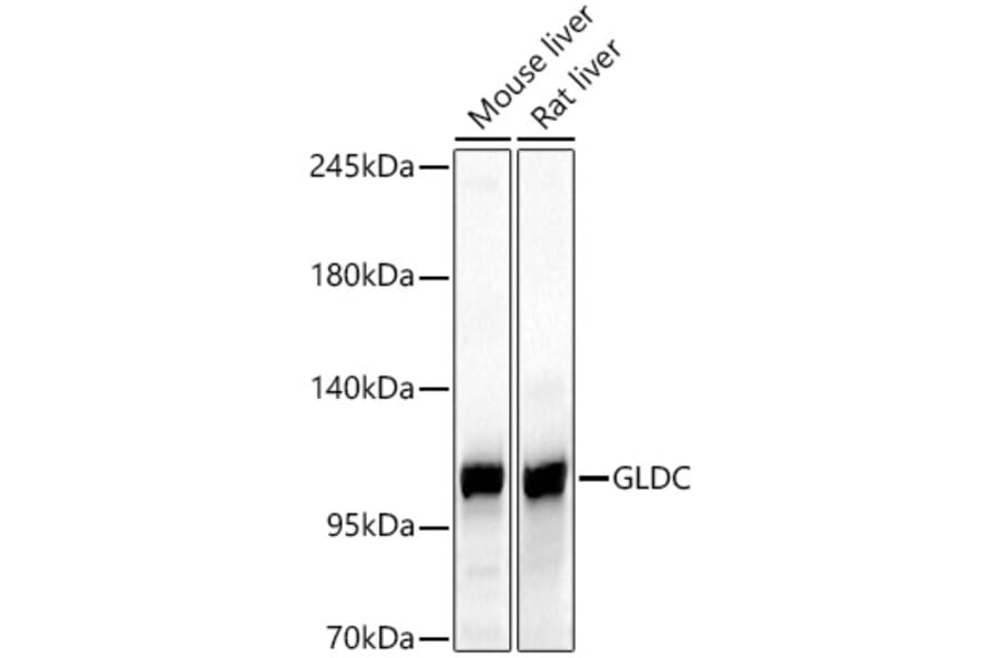 Western Blot - Anti-GLDC Antibody (A329404) - Antibodies.com