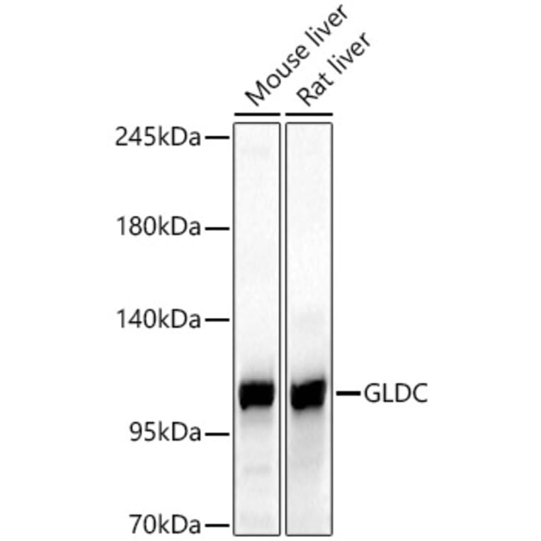 Western Blot - Anti-GLDC Antibody (A329404) - Antibodies.com