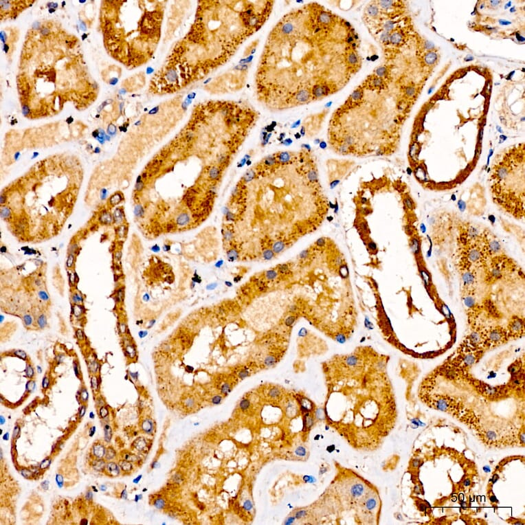 Immunohistochemistry - Anti-GLDC Antibody (A329404) - Antibodies.com