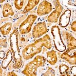 Immunohistochemistry - Anti-GLDC Antibody (A329404) - Antibodies.com