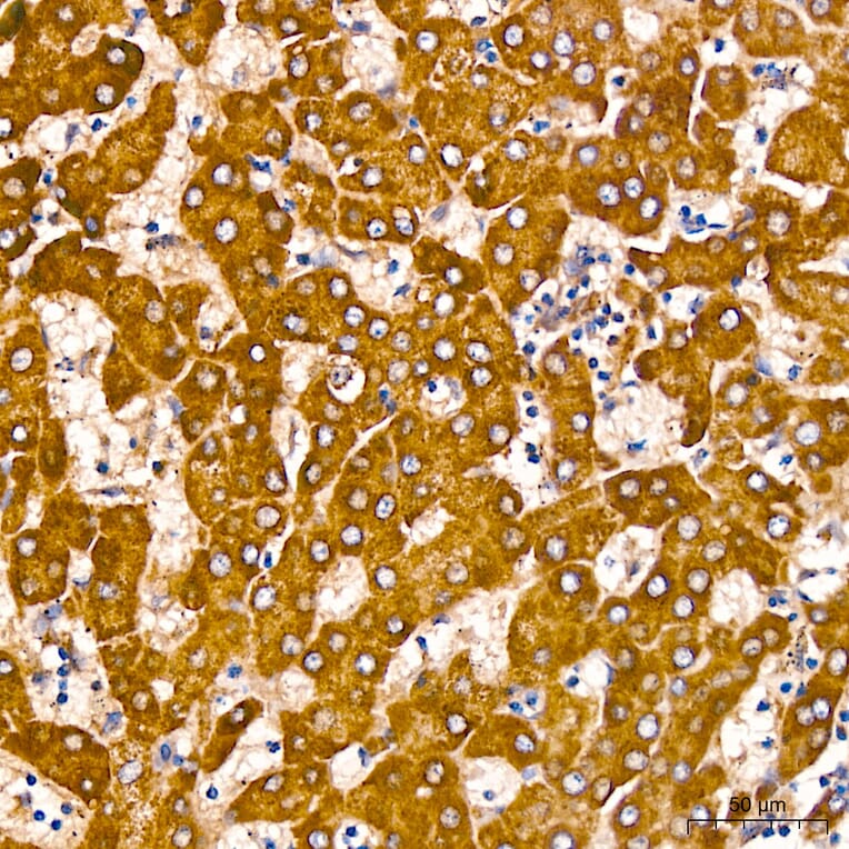 Immunohistochemistry - Anti-GLDC Antibody (A329404) - Antibodies.com