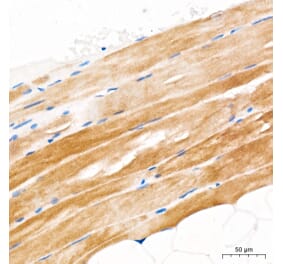 Immunohistochemistry - Anti-GLUT4 Antibody (A329405) - Antibodies.com