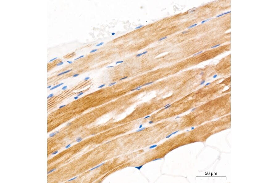 Immunohistochemistry - Anti-GLUT4 Antibody (A329405) - Antibodies.com