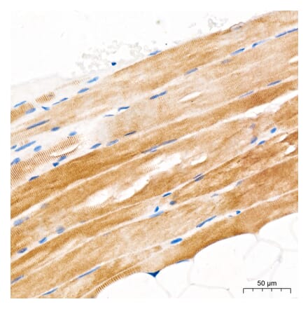 Immunohistochemistry - Anti-GLUT4 Antibody (A329405) - Antibodies.com