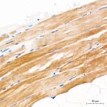 Immunohistochemistry - Anti-GLUT4 Antibody (A329405) - Antibodies.com