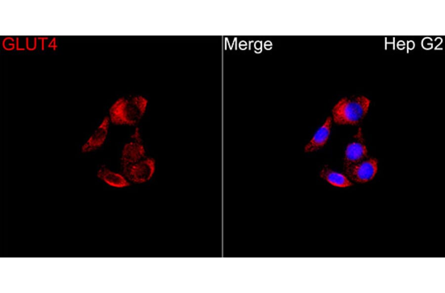 Immunofluorescence - Anti-GLUT4 Antibody (A329405) - Antibodies.com