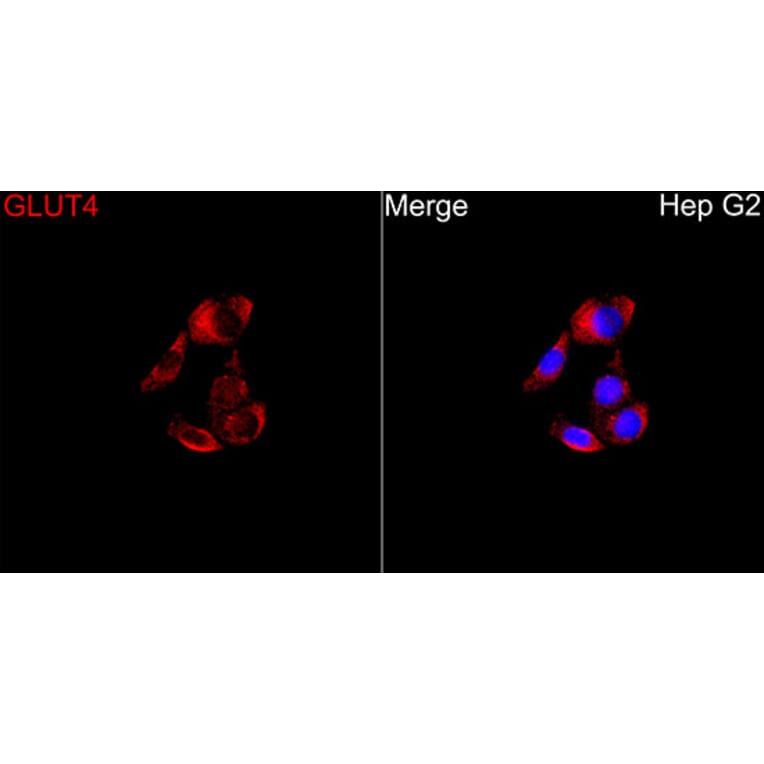 Immunofluorescence - Anti-GLUT4 Antibody (A329405) - Antibodies.com