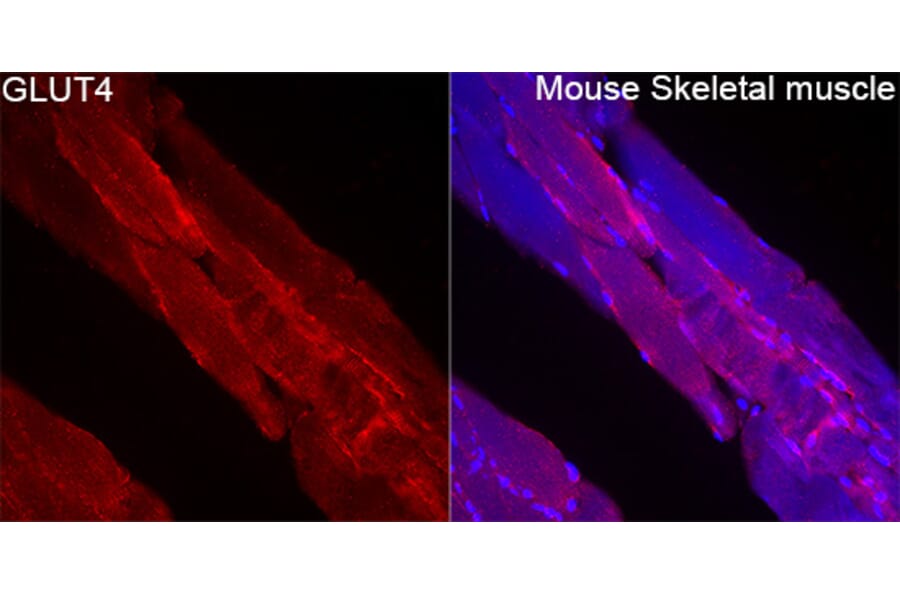 Immunofluorescence - Anti-GLUT4 Antibody (A329405) - Antibodies.com
