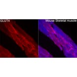 Immunofluorescence - Anti-GLUT4 Antibody (A329405) - Antibodies.com