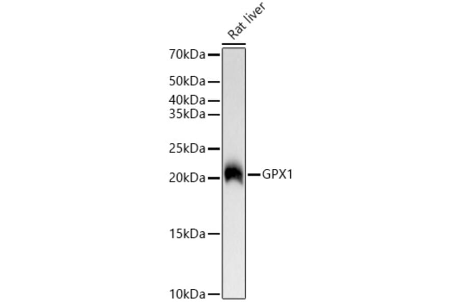 Western Blot - Anti-Glutathione Peroxidase 1 Antibody [ARC53251] (A329406) - Antibodies.com