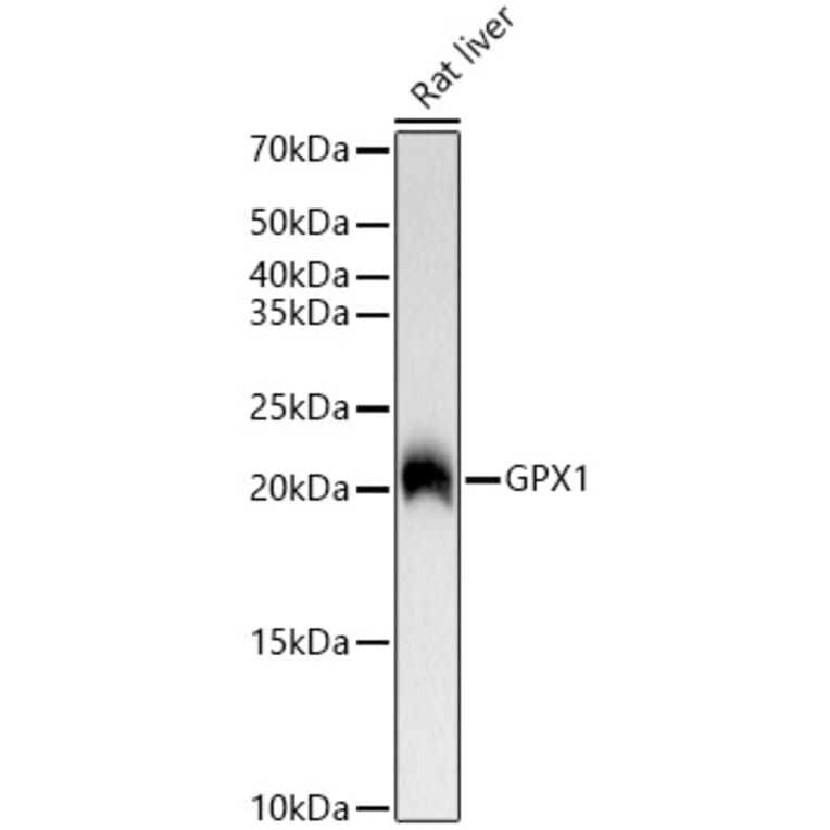 Western Blot - Anti-Glutathione Peroxidase 1 Antibody [ARC53251] (A329406) - Antibodies.com