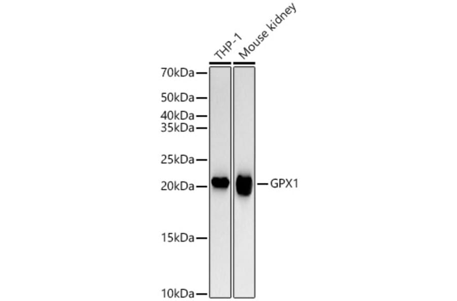 Western Blot - Anti-Glutathione Peroxidase 1 Antibody [ARC53251] (A329406) - Antibodies.com
