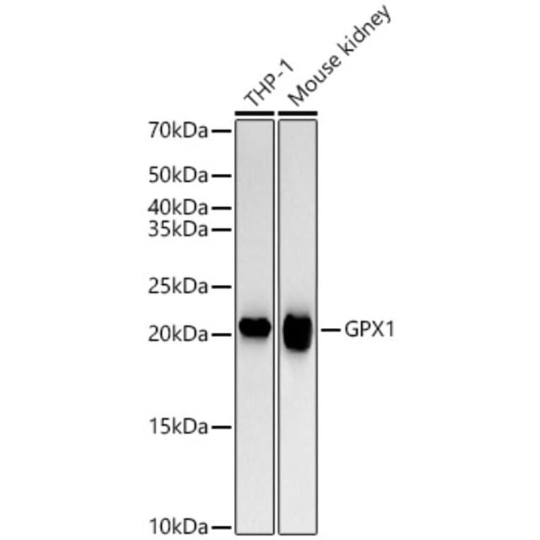 Western Blot - Anti-Glutathione Peroxidase 1 Antibody [ARC53251] (A329406) - Antibodies.com