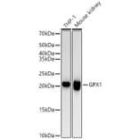 Western Blot - Anti-Glutathione Peroxidase 1 Antibody [ARC53251] (A329406) - Antibodies.com