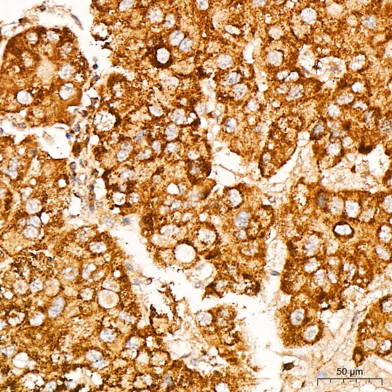 Immunohistochemistry - Anti-Glutathione Peroxidase 1 Antibody [ARC53251] (A329406) - Antibodies.com