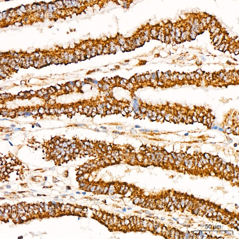 Immunohistochemistry - Anti-Glutathione Peroxidase 1 Antibody [ARC53251] (A329406) - Antibodies.com