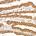 Immunohistochemistry - Anti-Glutathione Peroxidase 1 Antibody [ARC53251] (A329406) - Antibodies.com
