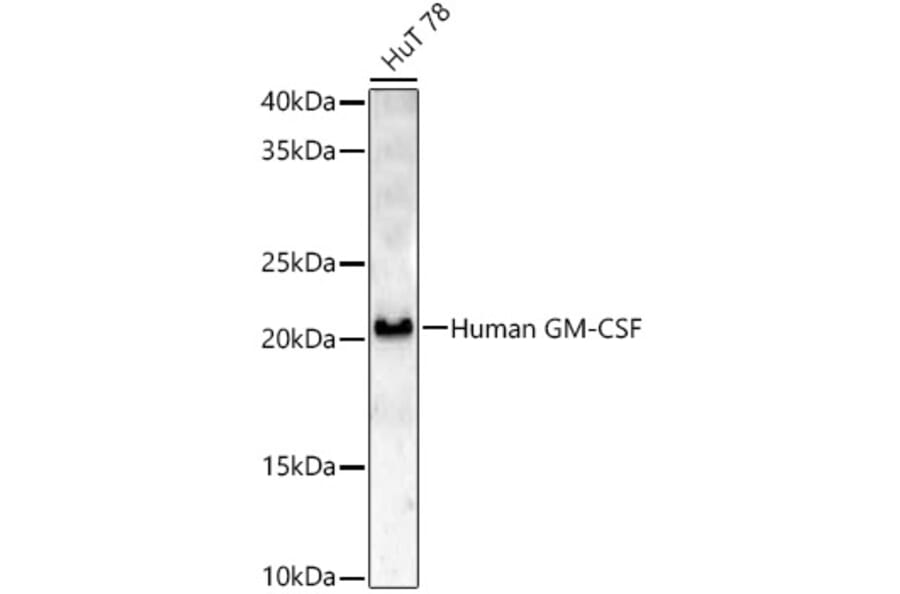 Western Blot - Anti-GM-CSF Antibody (A329409) - Antibodies.com