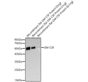 Western Blot - Anti-GM-CSF Antibody (A329410) - Antibodies.com