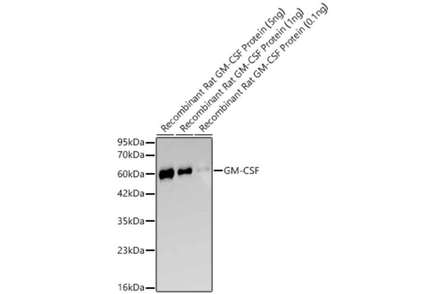 Western Blot - Anti-GM-CSF Antibody [ARC64162] (A329410) - Antibodies.com