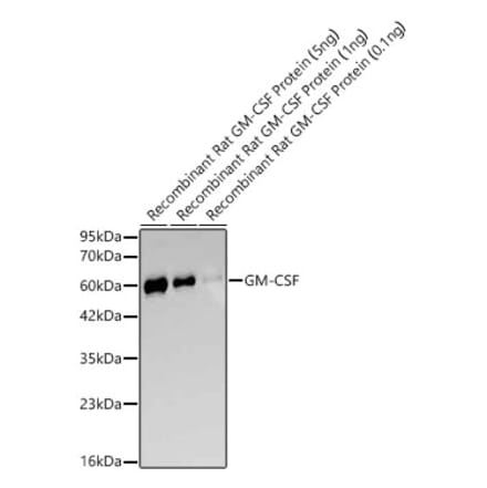 Western Blot - Anti-GM-CSF Antibody [ARC64162] (A329410) - Antibodies.com