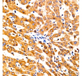 Immunohistochemistry - Anti-GNA13 Antibody (A329411) - Antibodies.com