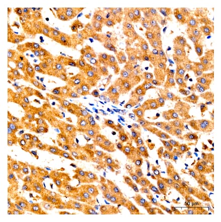 Immunohistochemistry - Anti-GNA13 Antibody (A329411) - Antibodies.com