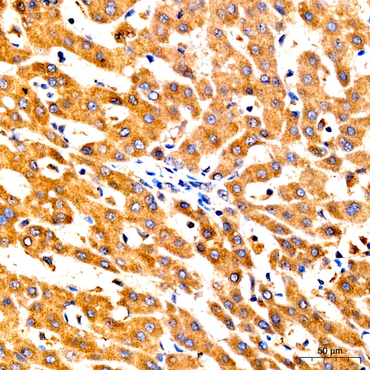 Immunohistochemistry - Anti-GNA13 Antibody (A329411) - Antibodies.com