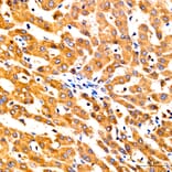 Immunohistochemistry - Anti-GNA13 Antibody (A329411) - Antibodies.com