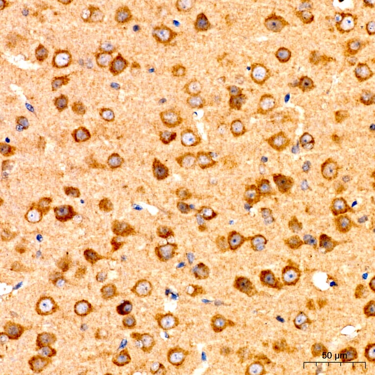 Immunohistochemistry - Anti-GNA13 Antibody (A329411) - Antibodies.com