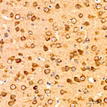 Immunohistochemistry - Anti-GNA13 Antibody (A329411) - Antibodies.com