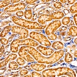 Immunohistochemistry - Anti-GNA13 Antibody (A329411) - Antibodies.com