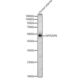 Western Blot - Anti-GP6 Antibody (A329413) - Antibodies.com