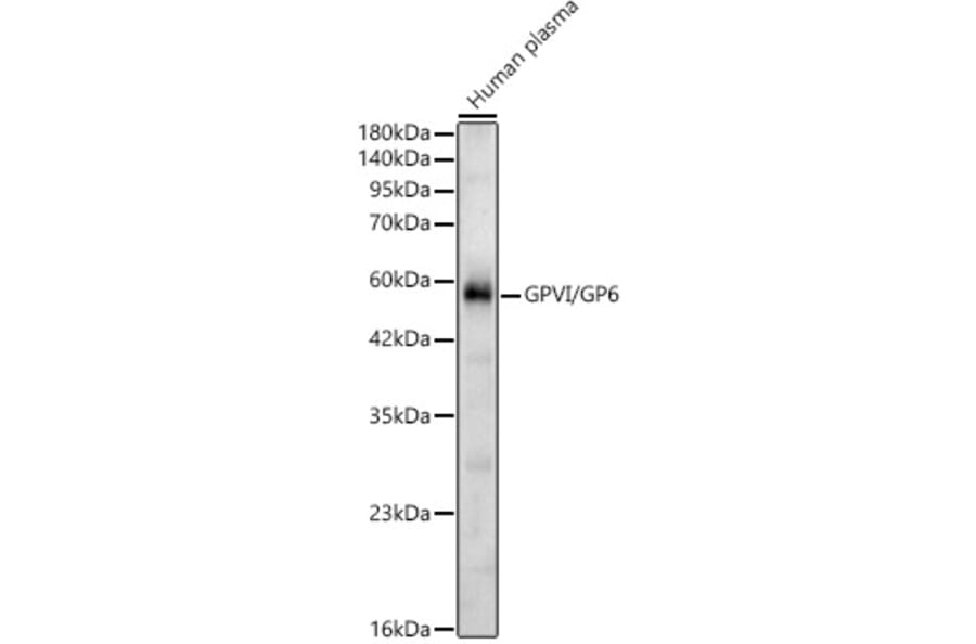 Western Blot - Anti-GP6 Antibody (A329413) - Antibodies.com