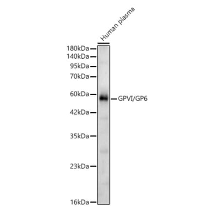 Western Blot - Anti-GP6 Antibody (A329413) - Antibodies.com