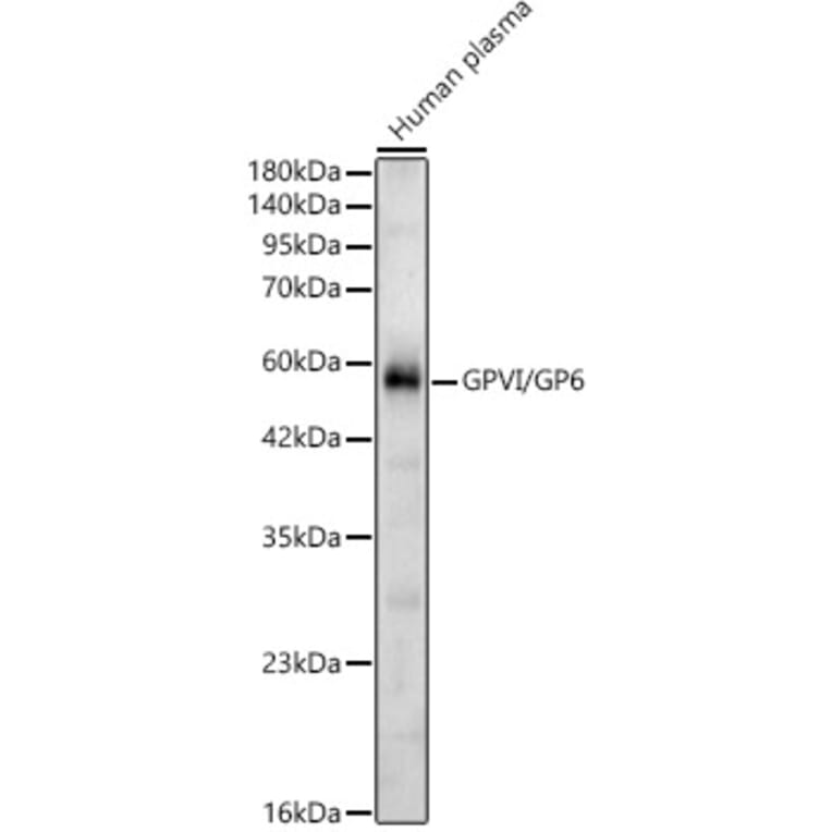 Western Blot - Anti-GP6 Antibody (A329413) - Antibodies.com