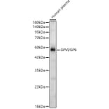 Western Blot - Anti-GP6 Antibody (A329413) - Antibodies.com
